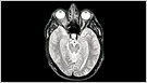 Bill Gates supports the AI price of Alzheimer’s ideas, which gives $ 1 million to a team for AI for "accelerate the revolutionary discoveries of existing Alzheimer’s data" (Stephen Morris / Financial Times)